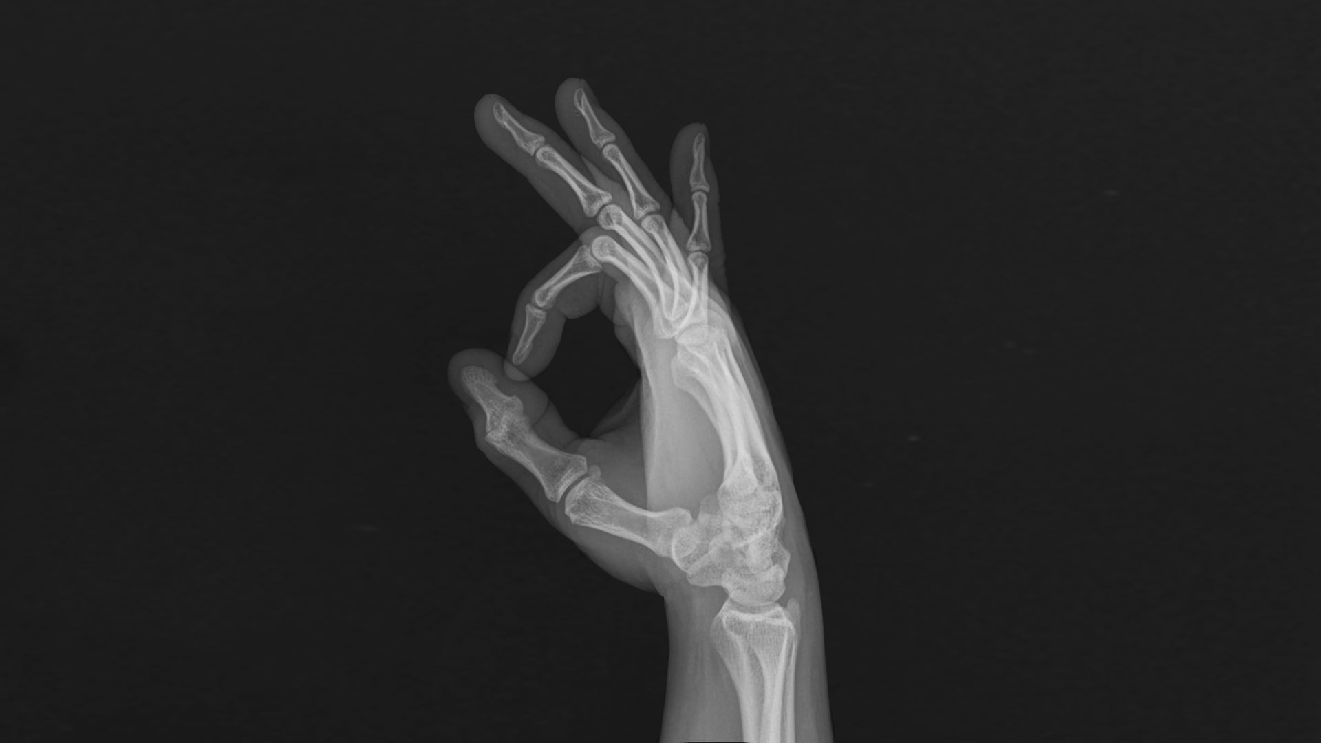 fingers, x-rays, bones, hands