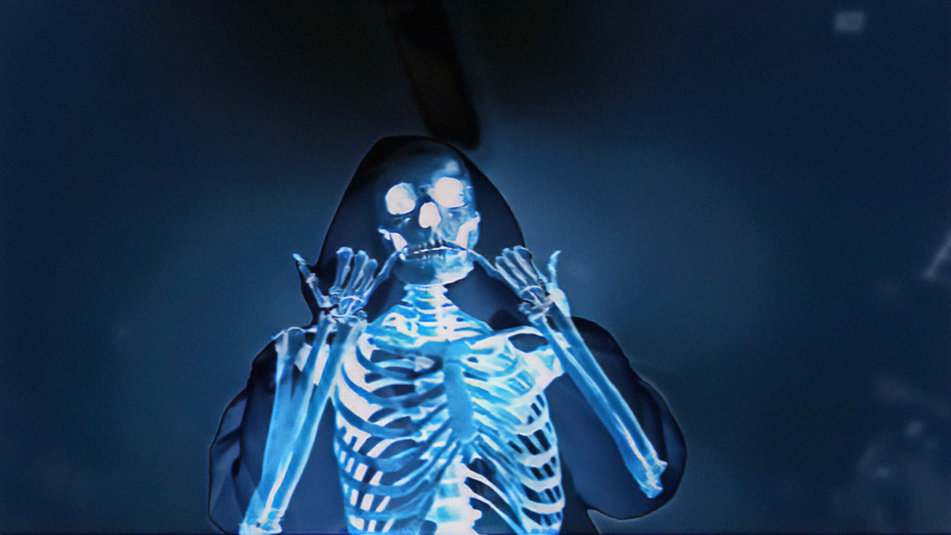 rondodasosa, Rapper, drill, skeleton, x-rays, skull, simple background