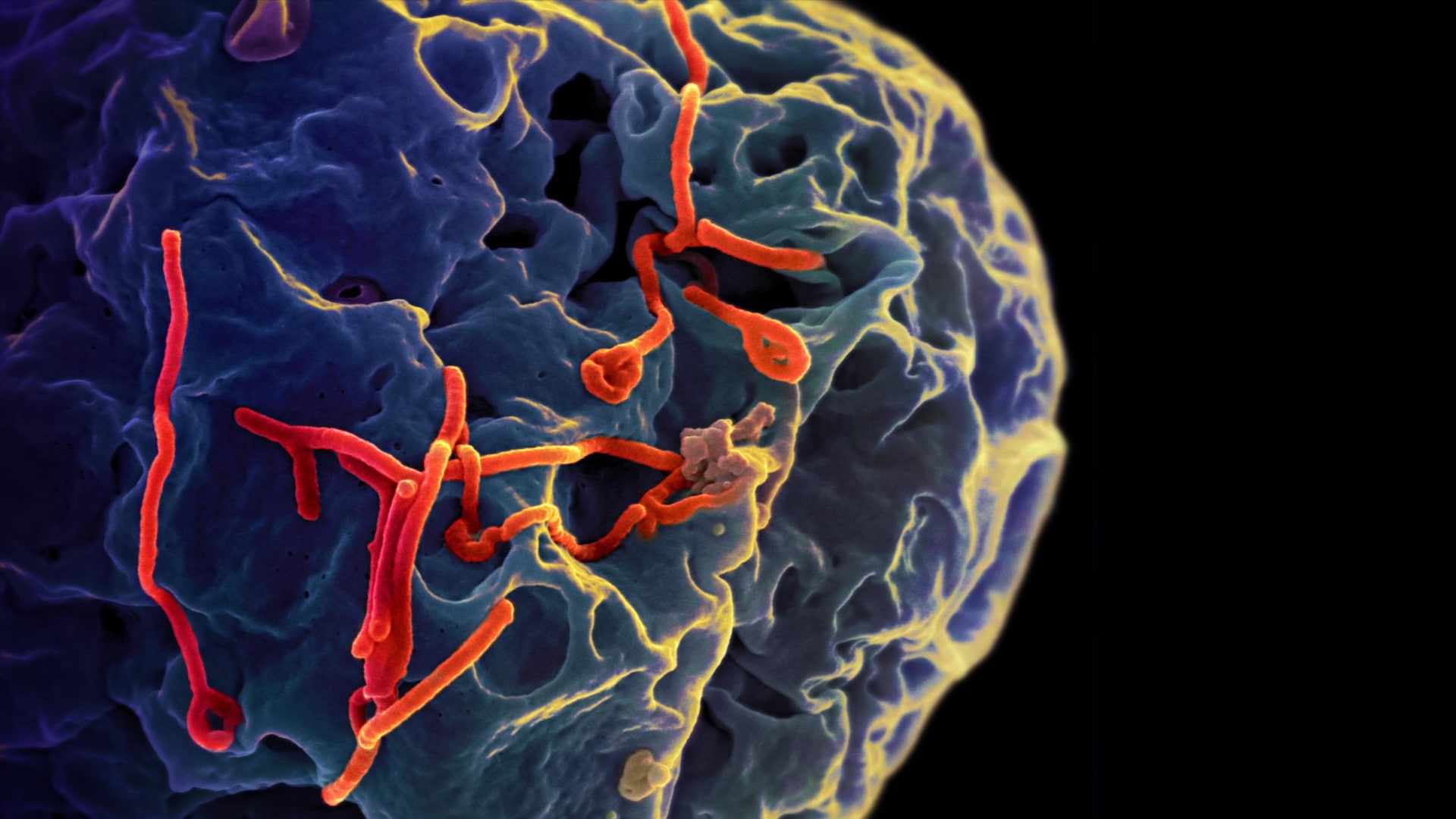 digital art colorful disease cells ebola