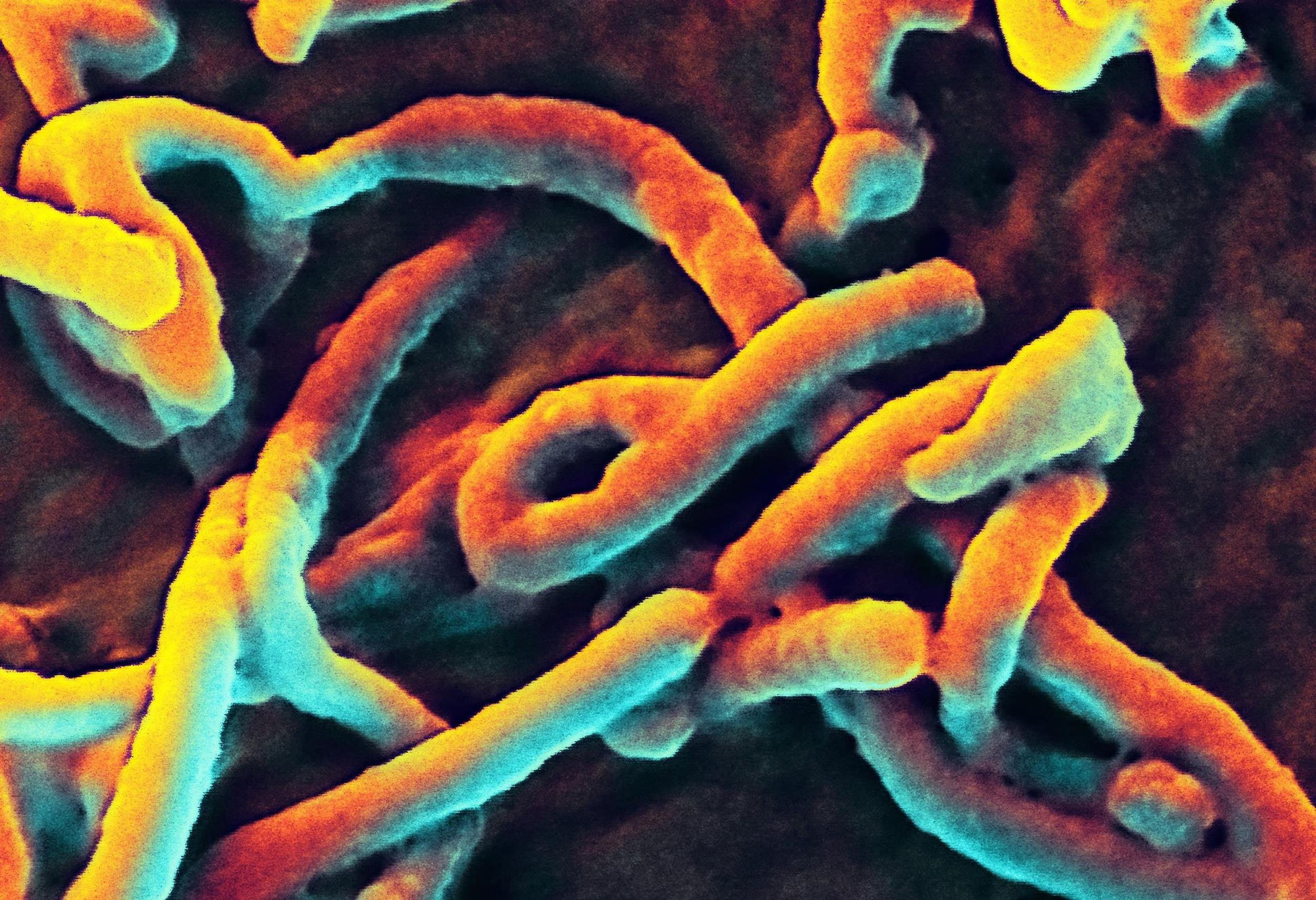 Dark, Disease, Ebola, horror, Medical, Virus